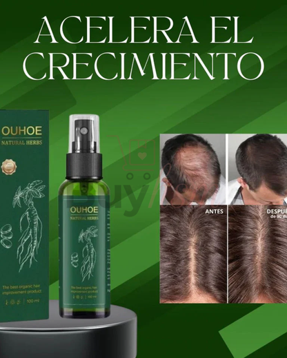 OUHOE Natural Herbs _ Spray Capilar Anticaída